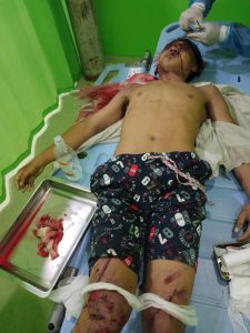 Laka Lantas Di Sergai, Seorang Pengendara Sepeda Motor Tewas, 2 Luka Berat