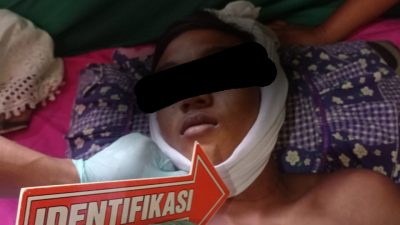 Gegara Nasi Basi, Remaja Di Dolok Masihul Tewas Gantung Diri
