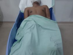 Wartawan di Medan Disiram Air Keras OTK, Wajahnya Luka Serius