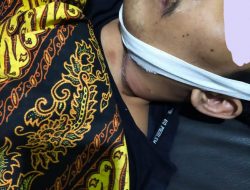 Pemuda di Loteng ditemukan Meninggal Gantung Diri