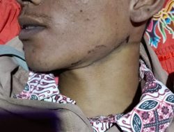 Ahmad Farhan Ditemukan Gantung Diri di Rumah Kosong